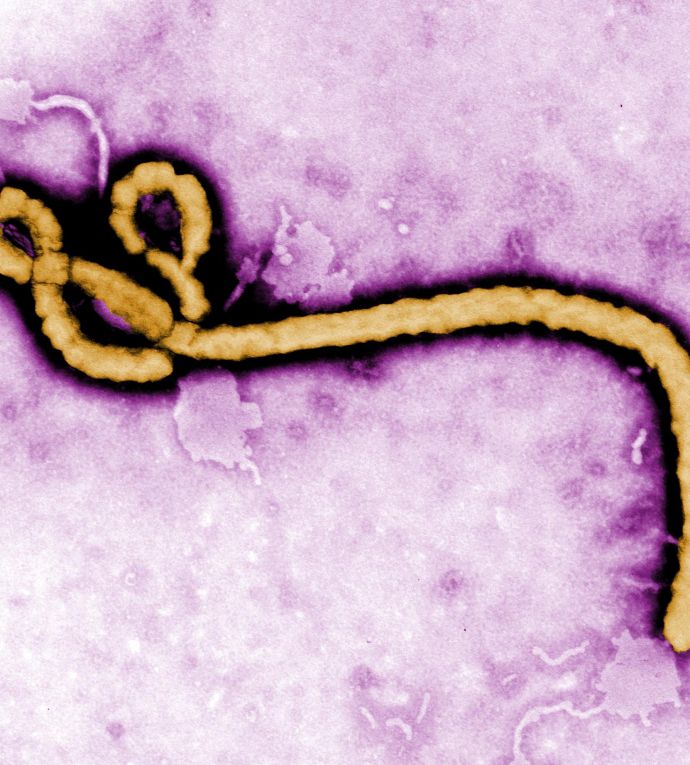 Image de l'article En RDC, Ebola fragilise la lutte contre le VIH